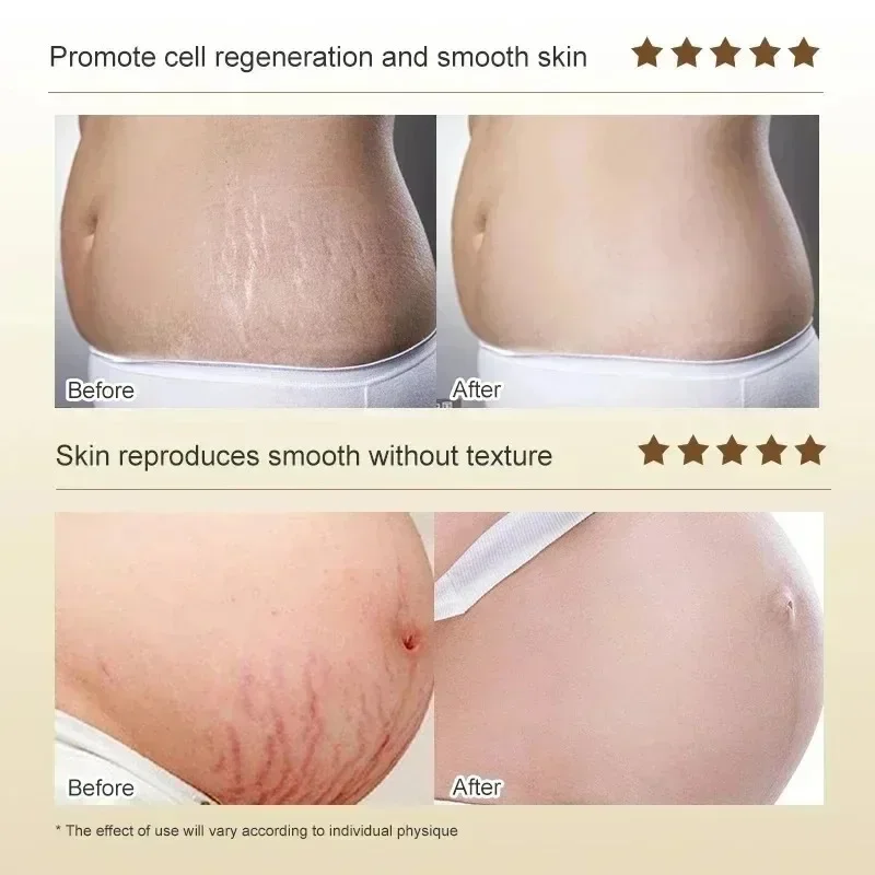 Crema de eliminación permanent - Skincare Oat reseña y precio